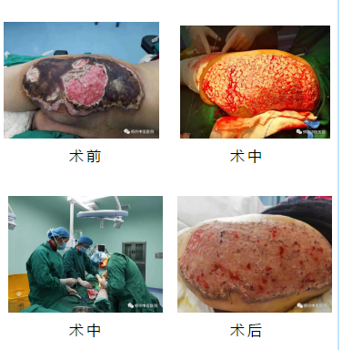 骨伤科手术简讯1